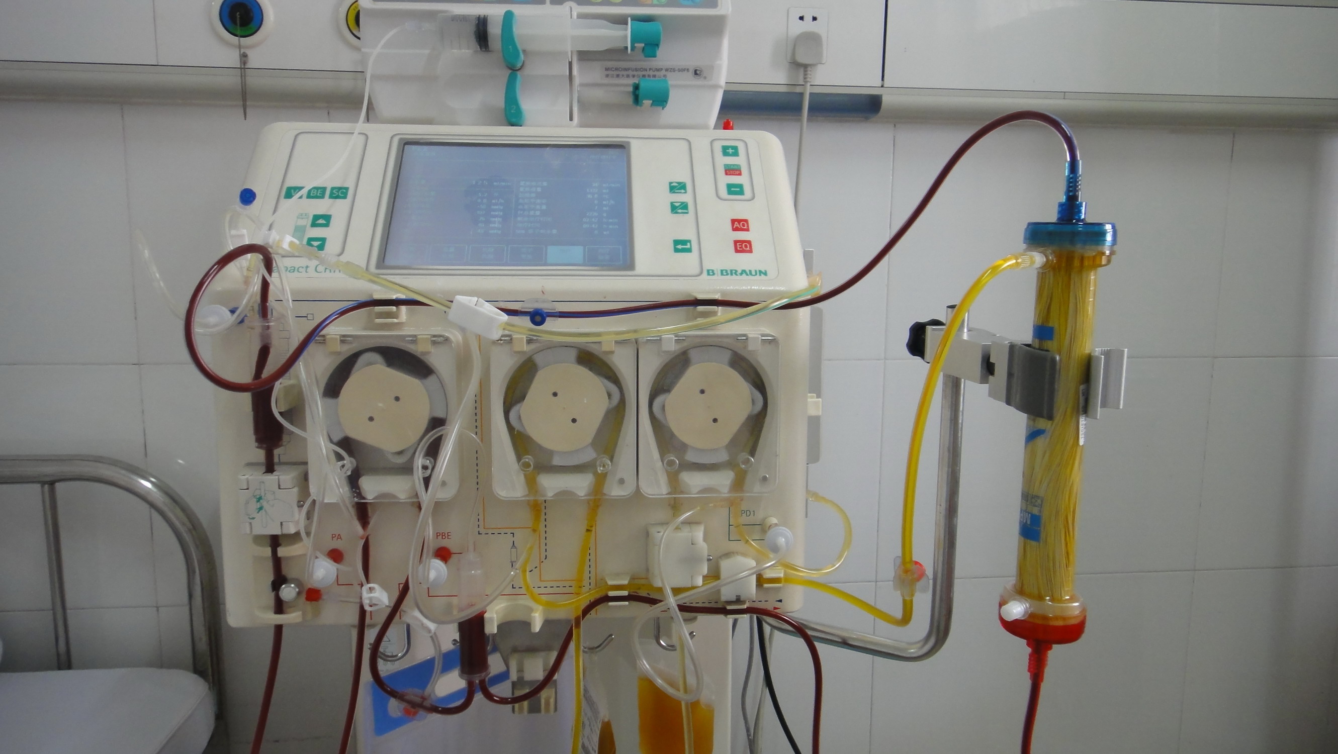 人工肝支持系统治疗各型重症肝炎技术