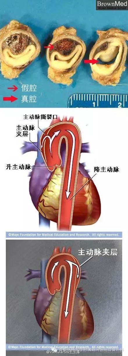 什么症状可以看血管外科