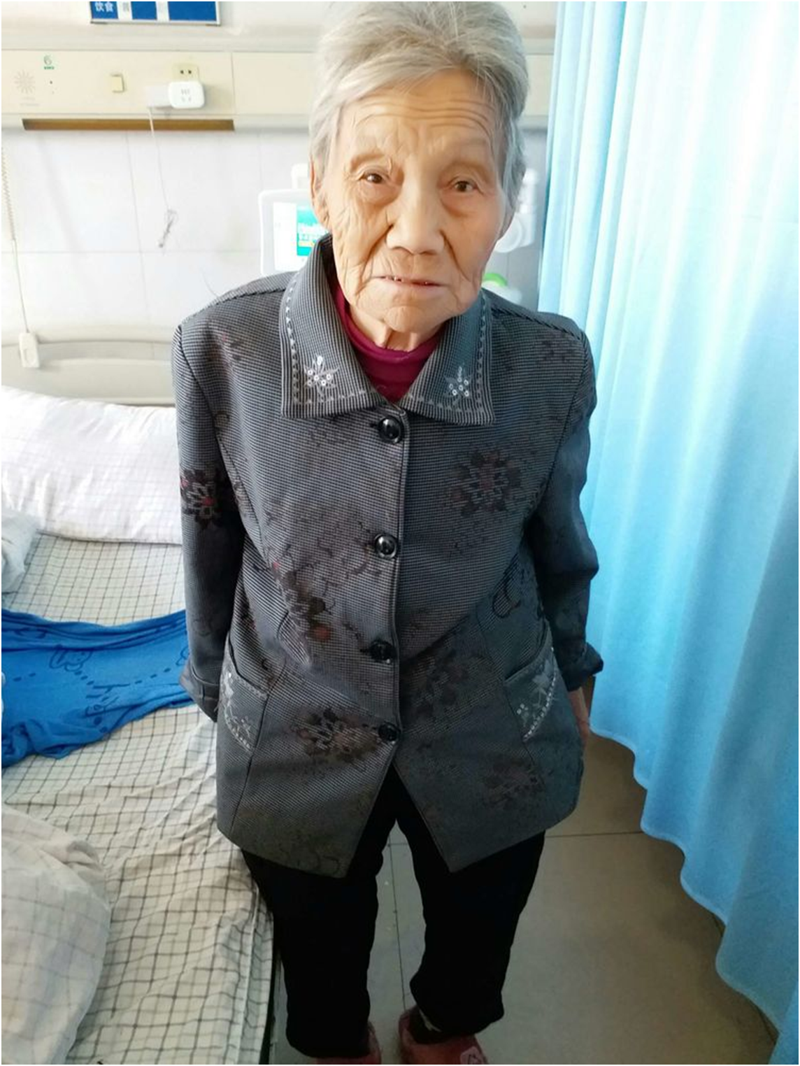 阜阳市二院成功为一例高龄驼背老人开展十二指肠球部穿孔术